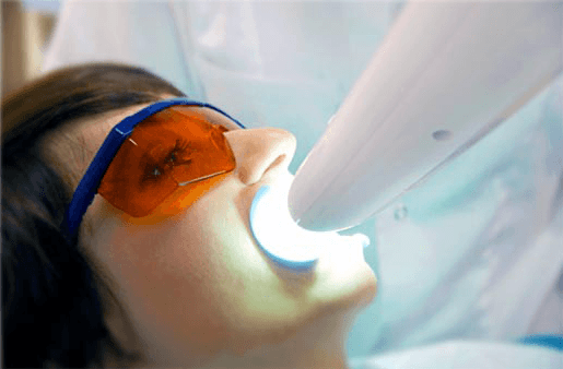 Understanding the Causes of Teeth Sensitivity Scunthorpe