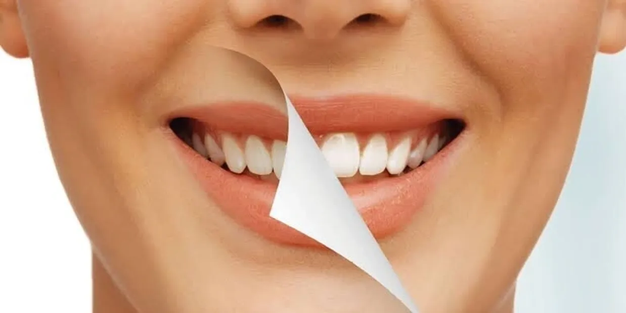 How Dentists Assess Your Teeth for Safe Whitening Results