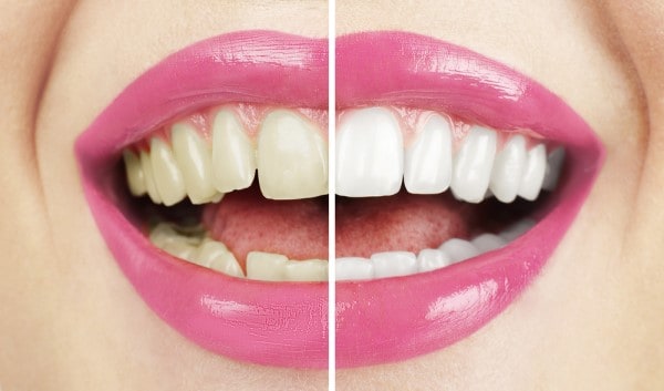 What Early Signs of Oral Cancer Should You Never Ignore Scunthorpe?