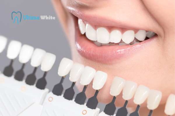 How to Maximise the Results of Your Laser Teeth Whitening Treatment Scunthorpe