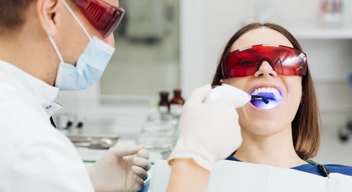 Do Dental Crowns Change Colour After Teeth Whitening Scunthorpe?