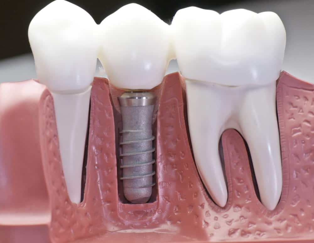 Common Misconceptions About Modern Dental Treatments Scunthorpe