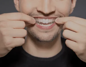 Overview of Home Teeth Whitening Kits Scunthorpe
