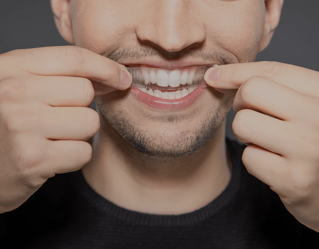 Can You Whiten Natural Teeth Without Harsh Chemicals Scunthorpe?