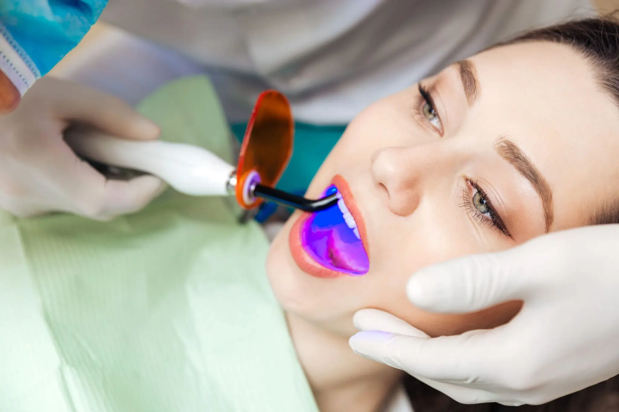 Common Risks of Whitening Without Expert Dental Guidance Scunthorpe