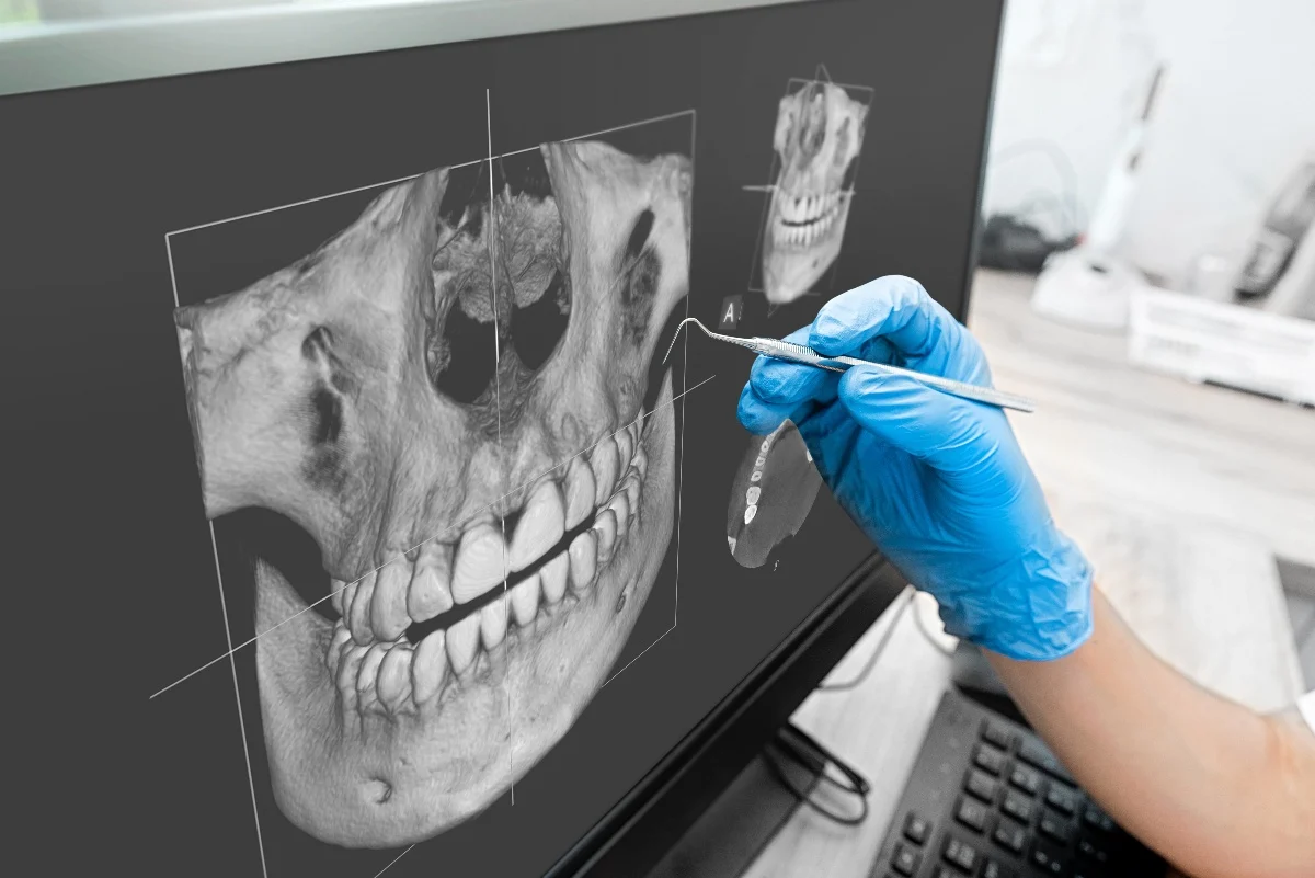 Key Benefits of 3D Printing for Patients and Dentists Scunthorpe