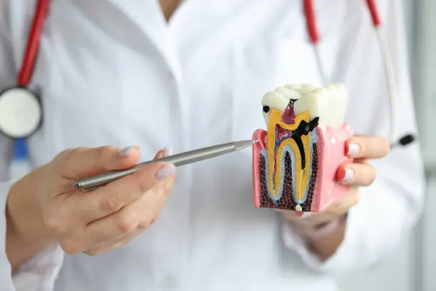 The Silent Culprits: Common Habits That Damage Your Teeth Scunthorpe