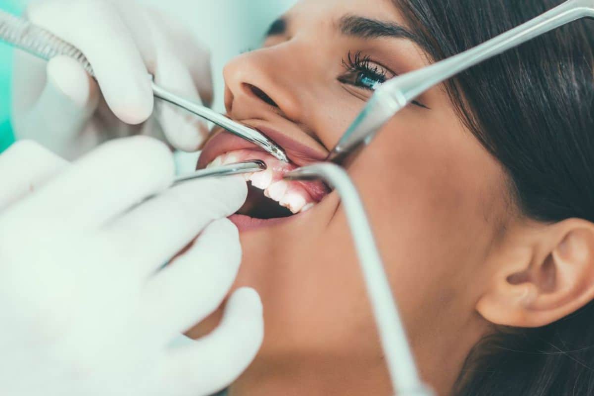 Can Laser Whitening Damage Your Enamel or Cause Long-Term Harm Scunthorpe?