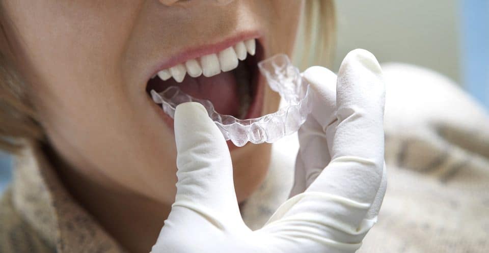 Can Bruxism Affect Your Sleep Quality Scunthorpe