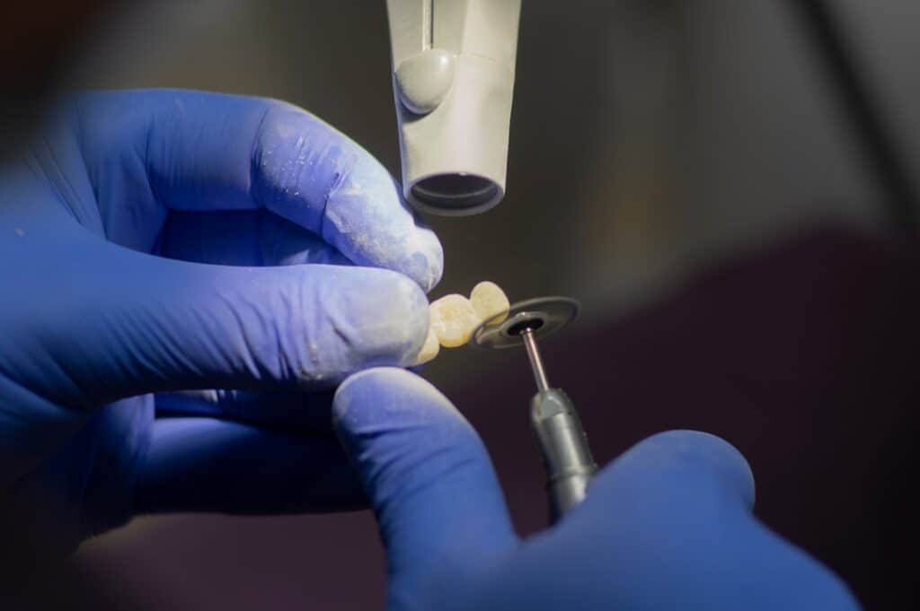 Customised Dental Solutions: Crowns, Aligners, and Implants Scunthorpe