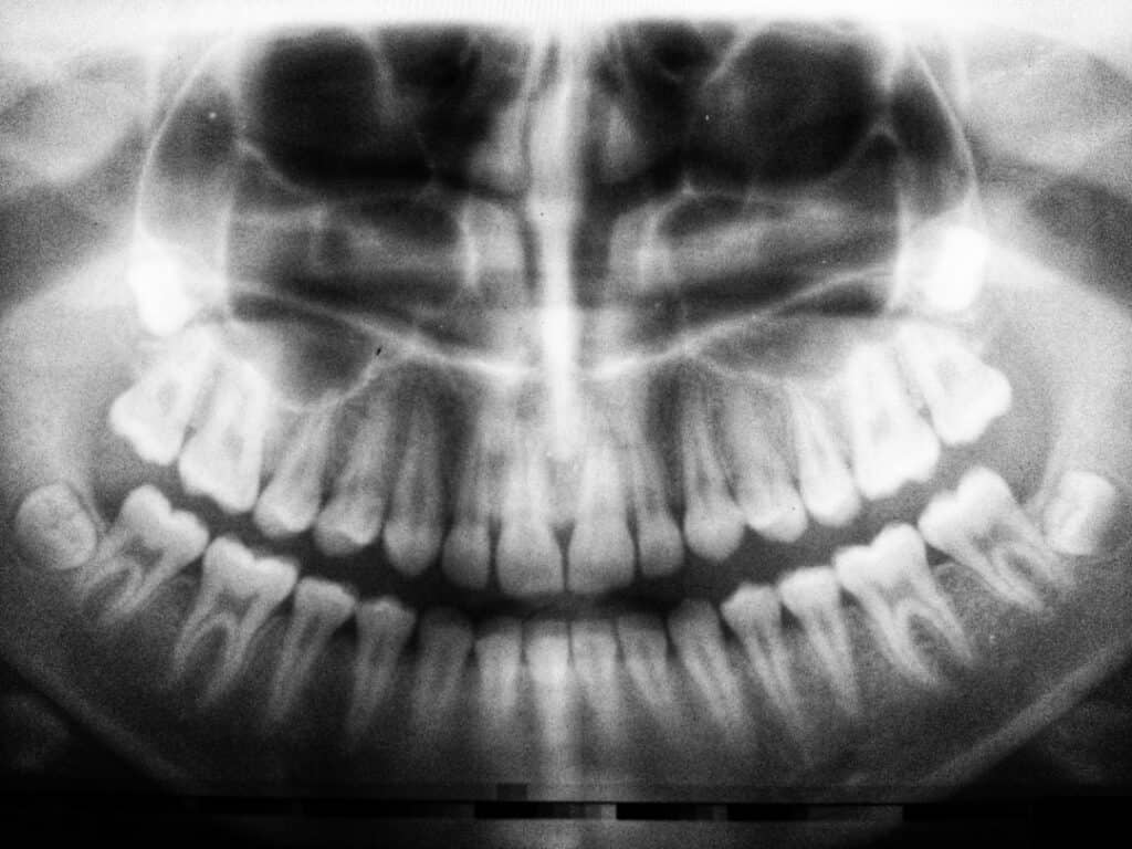 The Future of 3D Printing in Oral Healthcare Scunthorpe